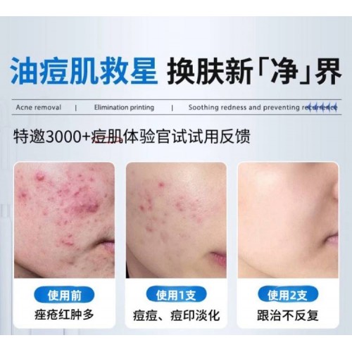 JM中脉·痘痘清18g*3支