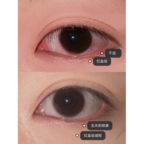 德国HEALMUSZ蓝莓叶黄素滴眼液*5瓶