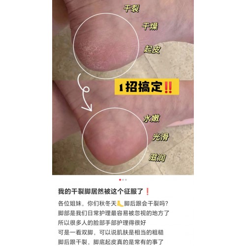 珀薇娜红花皲裂膏98g*2瓶