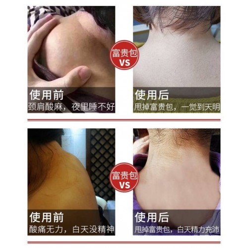 走珠型氨糖软骨素富贵包舒缓液2瓶