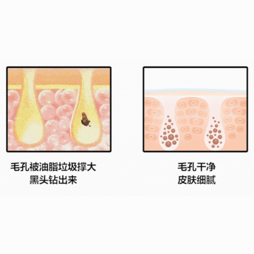 Honey future 净澈鼻贴膜组合